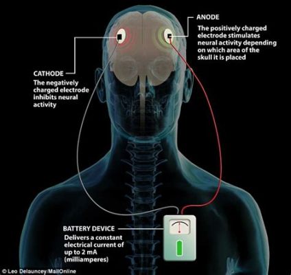 Cranium: A Symphony of Cerebral Stimulation!